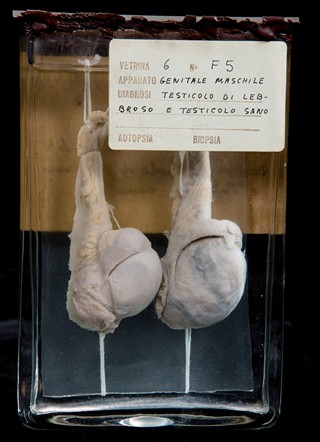 Anatomia Patologica - Orchite lebbrosa