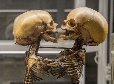 Museo di Anatomia Patologica